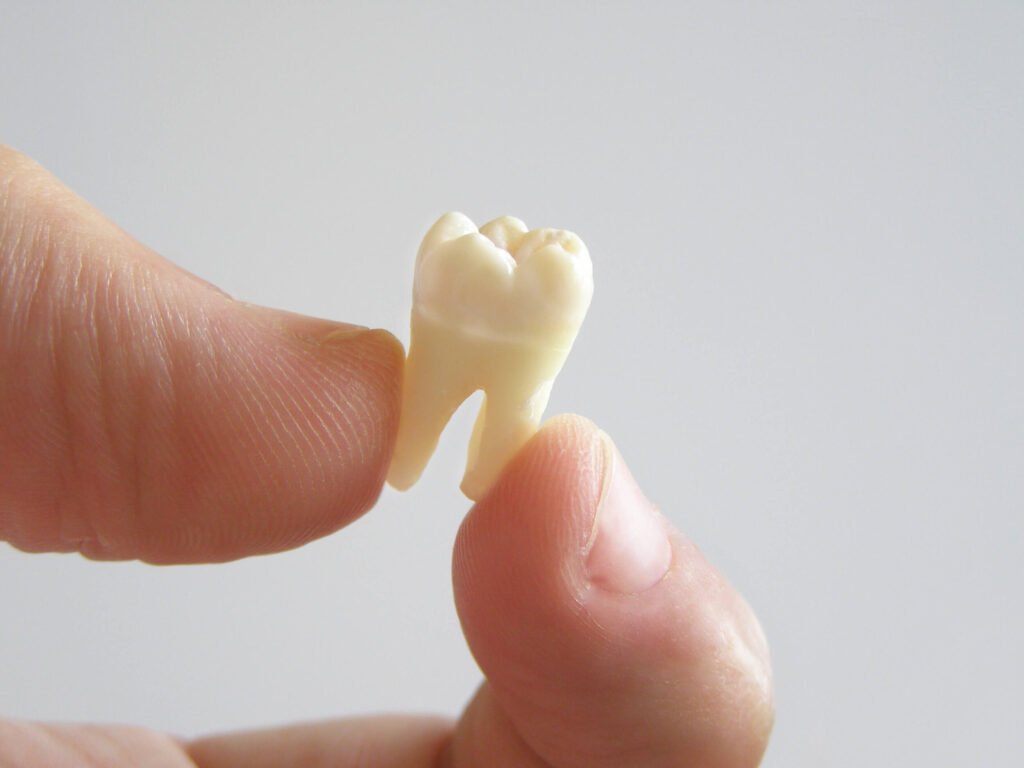 Dreaming of Teeth Falling Out in Islam - Sakeena Academy